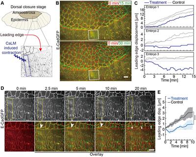 The Lateral Epidermis Actively Counteracts Pulling by the Amnioserosa During Dorsal Closure